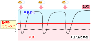 むし歯になってしまう条件は大きく分けてこの4つ！