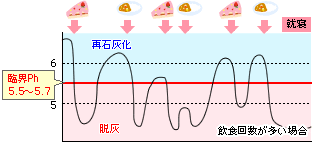 むし歯になってしまう条件は大きく分けてこの4つ！